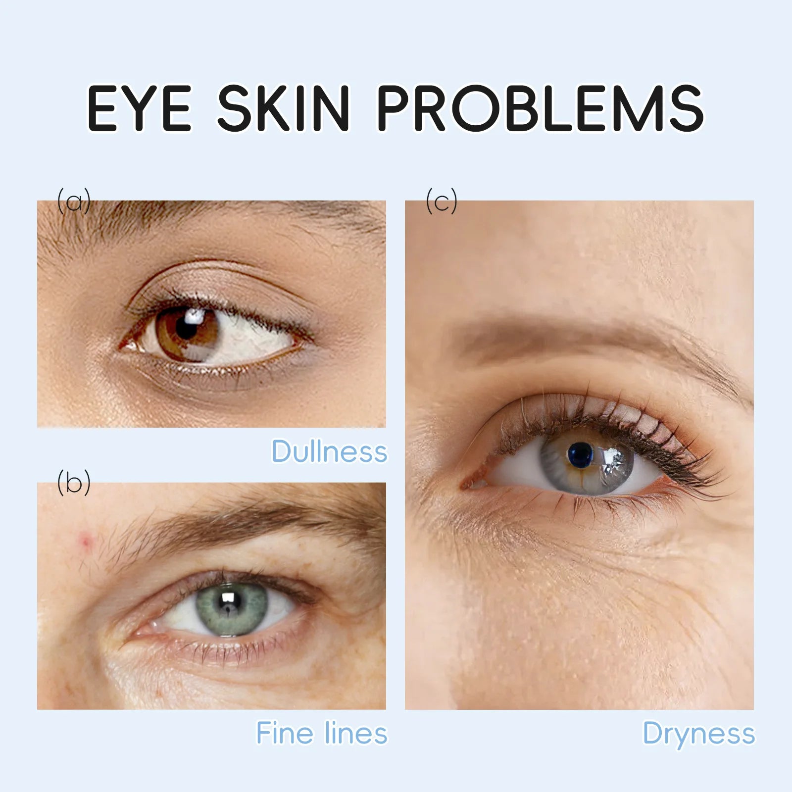 פאצ׳ים חלב לעיניים