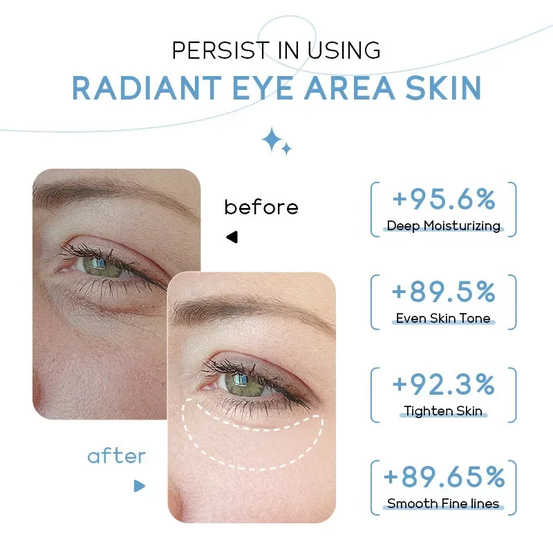 קרם עיניים | פורמולת חלב מזינה פחות קמטים, עור צעיר ורענן