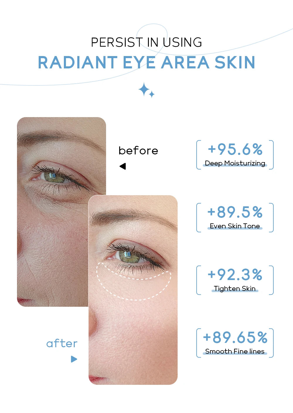 Milk Eye Cream